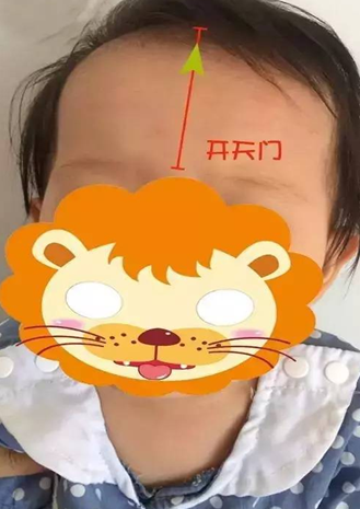开天门