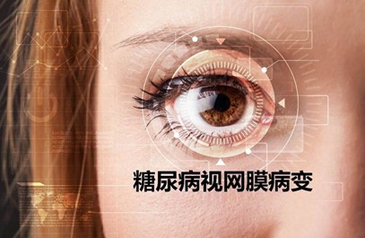 糖尿病眼病